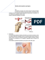 Métodos Anticonceptivos Quirúrgicos