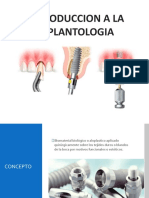 Introduccion Implantologia