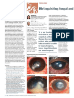 Distinguishing Fungal and Bacterial Keratitis On Clinical Signs PDF