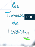 Les-Tumeurs-de-lovaire-