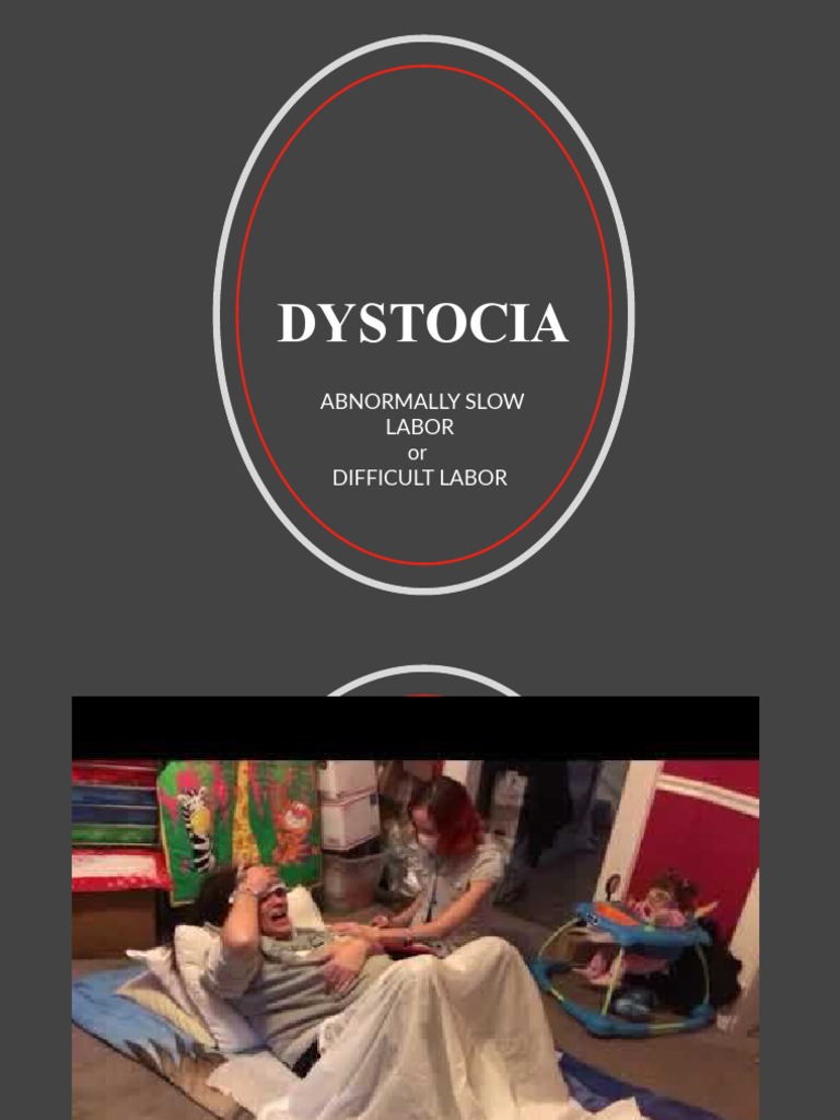 Dystocia: Abnormally Slow Labor or Difficult Labor | PDF | Childbirth ...