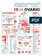 190510-30-cancer-ovario