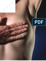 Bilateral Total Modified Radical Mastectomy and Reconstruction