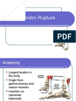 Achilles Tendon Rupture Anatomy, Causes, Diagnosis and Treatment