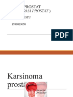 Karsinoma Prostat