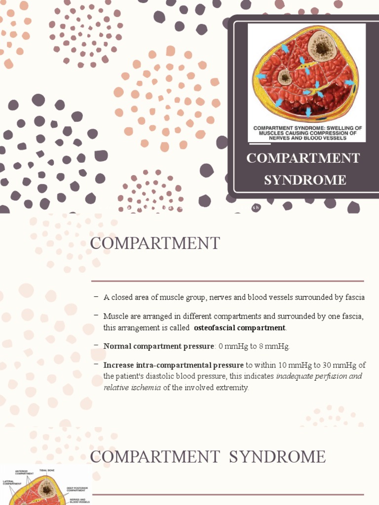 Compartment Syndrome A Ud I A F Fa N H I D A y Ul I y A N Ah U SN A