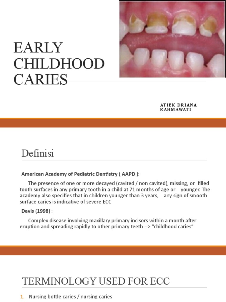 Understanding Early Childhood Caries | PDF | Oral Hygiene | Dentistry