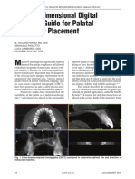 A Three-Dimensional Digital Insertion Guide For Palatal Miniscrew Placement