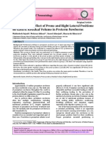 Comparison of Effect of Prone and Right Lateral Positions On Gastric Residual Volume in Preterm Newborns