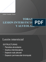 TORAX    lesion intersticial y alveolar