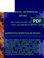 neumonia intersticial difusa 19 mayo