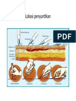 Lokasi Penyuntikan