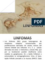Linfomas: Características clínicas y clasificación