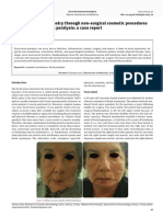 Restoring Facial Symmetry Through Non-Surgical Cosmetic Procedures After Permanent Facial Paralysis: A Case Report