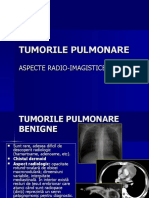 Curs Tumori Pulmonare