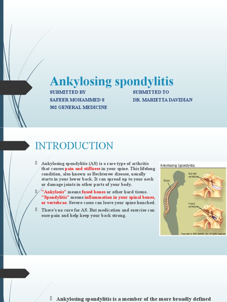 Ankylosing Spondylitis Overview | PDF | Diseases And Disorders ...