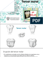 Copia de Tercer Molar