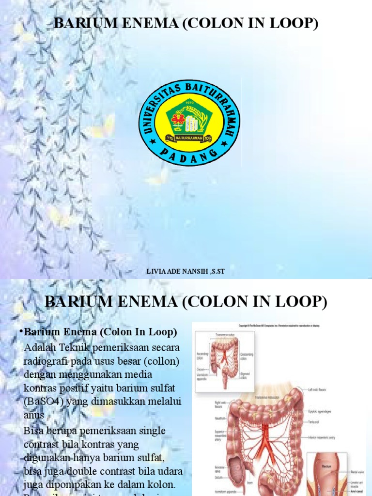 Barium Enema (Colon in Loop) PDF