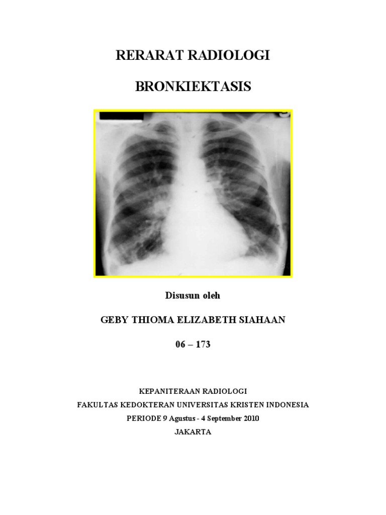 Radiology Report on Bronchiectasis | PDF | Wellness | Social Science
