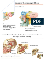 Infratemporalfossa Pps