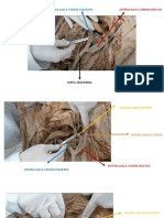 Arterias Pelvis y Miembro Inferior