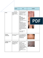 Penyakit Kulit Umum dengan Gambar