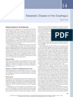 Neoplastic Disease of The Esophagus PDF