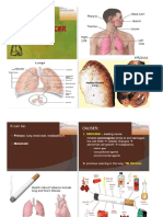 Lung Cancer