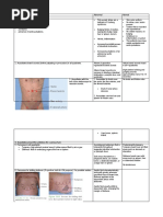 Ascites Examination Shifting Dullness Fluid Thrill Puddle Sign | PDF ...
