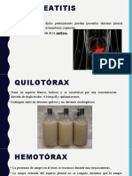 Derrame Pleural-2