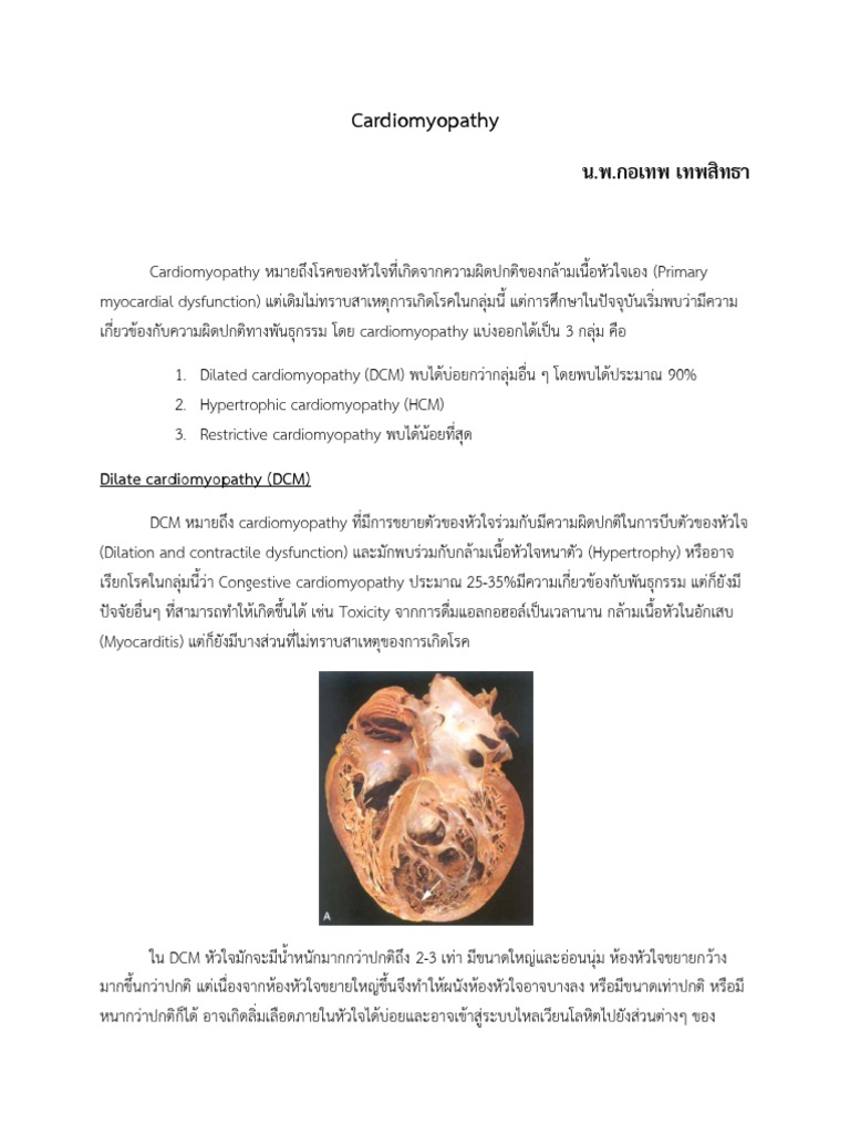 Cardiomyopathy 3 Pdf