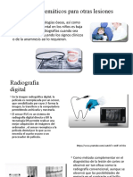 Radiografia Computarizada