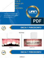 Enfermedad Gingival y Periodontal en Niños