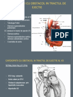 Cardiomiopatii Cu Obstacol in Tractul de Ejectie