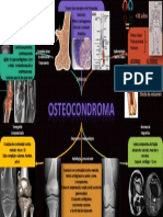 Osteocondroma.