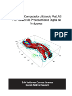 23371-procesamiento-de-imagenes-con-matlab-130407102958-phpapp01.pdf