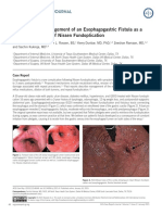 Naveed Et Al. - 2015 - Diagnosis and Management of an Esophagogastric Fistula as a Rare Complication of Nissen Fundoplication