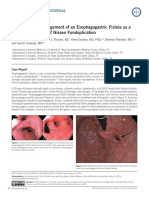 Naveed Et Al. - 2015 - Diagnosis and Management of An Esophagogastric Fistula As A Rare Complication of Nissen Fundoplication