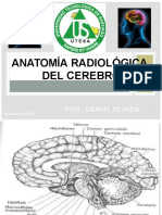 Anatomía Radiológica Del Cerebro