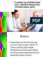 Hiperplasia Prostat