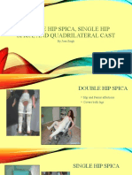 Double Hip Spica, Single Hip Spica, and Quadrilateral Cast