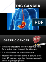 Gastric Cancer and Pancreatic