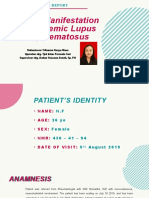 Oral Manifestation of Systemic Lupus Erythematosus: Case Report