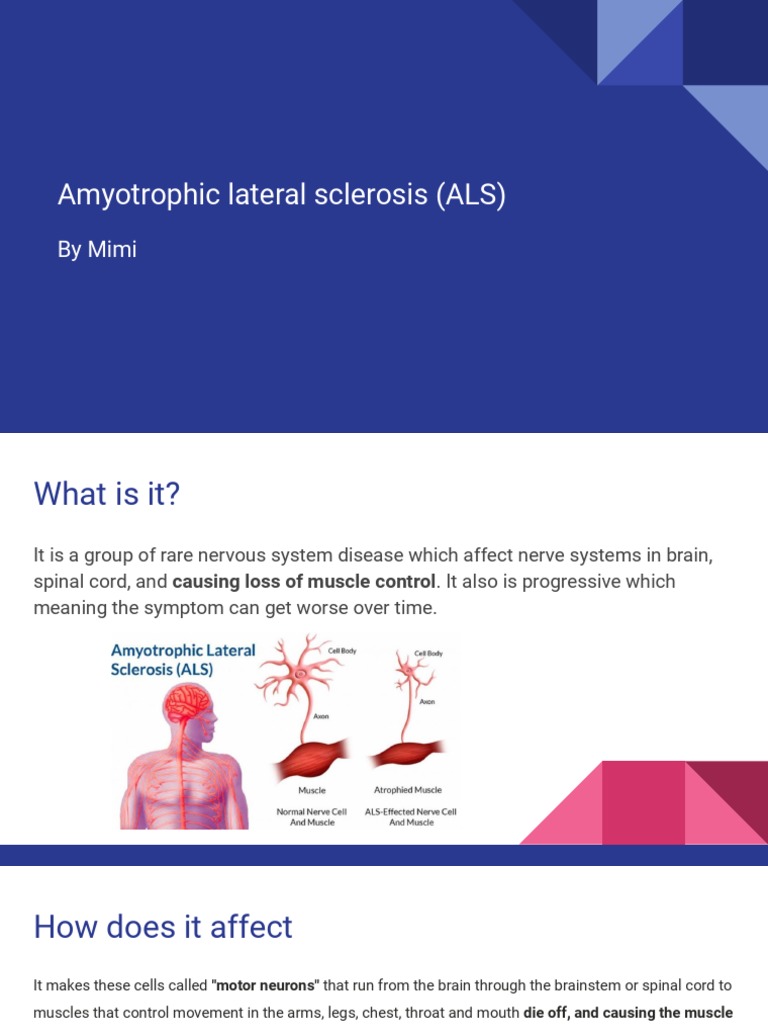 Amyotrophic Lateral Sclerosis Als | PDF | Amyotrophic Lateral Sclerosis ...