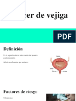 Cáncer de Vejiga