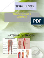 Arterial Ulcer