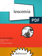 LEUCEMIA