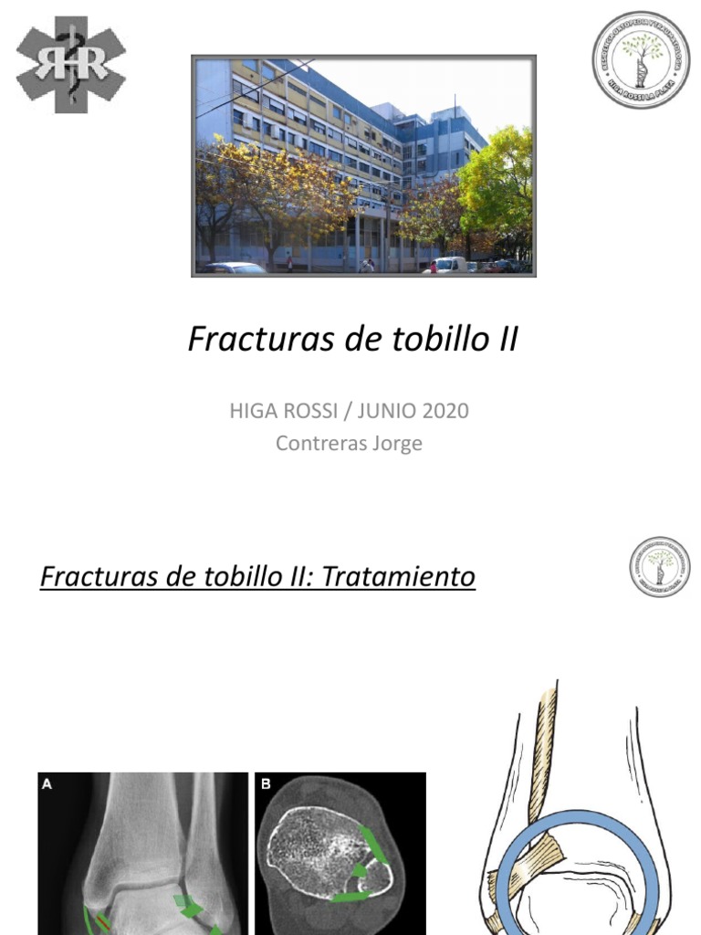 Cirugía de Rodilla por Artrosis - Dr. J. Galindo Contreras