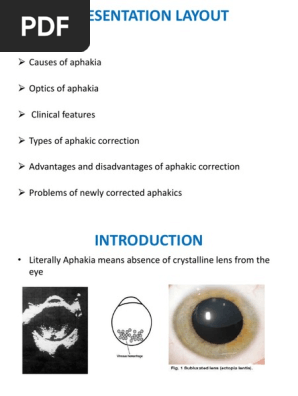 Aphakia vs Contact lens