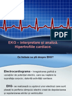 EKG-Interpretare-analiza